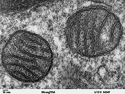 ミトコンドリアの透過型電子顕微鏡写真